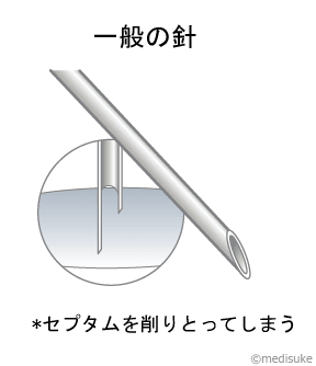 PICCとは／輸液治療に用いる医療機器について22