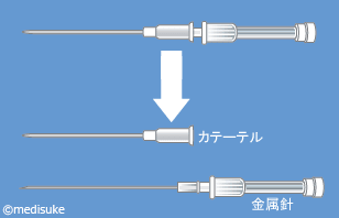 PICCとは／輸液治療に用いる医療機器について6